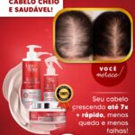 antes e depois