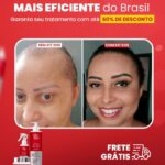 ants e depois 3