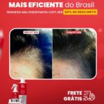 antes e depois